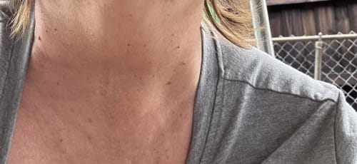 Customer photo review of ⁠Serum para el Cuello y brazos - 100ml