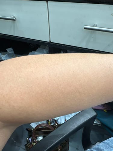 Customer photo review of PureSkin Ultra 9