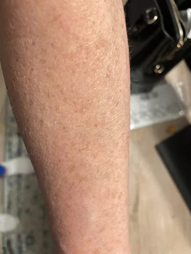 Customer photo review of Crema para Manos - 50ml