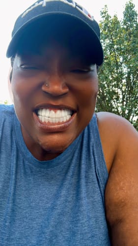 Customer photo review of Payment Plan - Pop On Veneers - With At Home Impression Kit