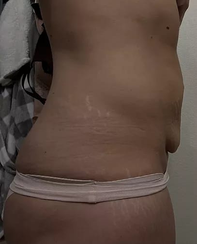 Customer photo review of ⁠Crema para la panza - 50ml