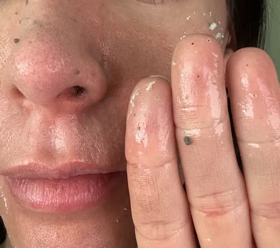 Customer photo review of Peel Shot Serum - ByLorai