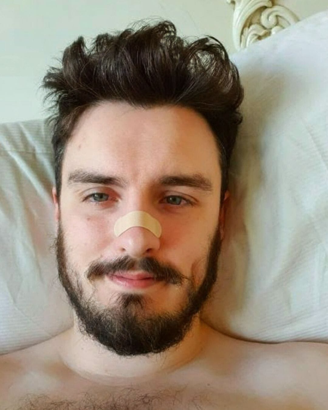 Customer photo review of Flowstrips® Nasenpflaster (30 Stück)