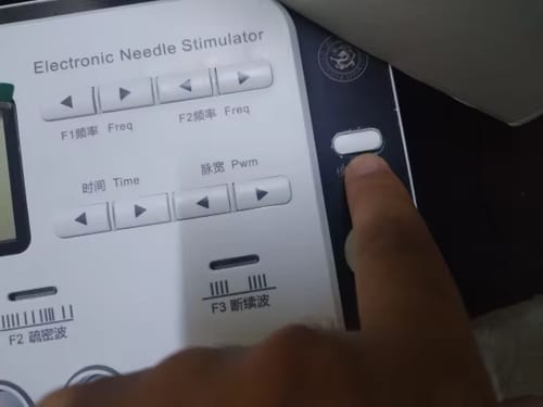 Customer photo review of TENS & Electroacupuncture Muscle Stimulator