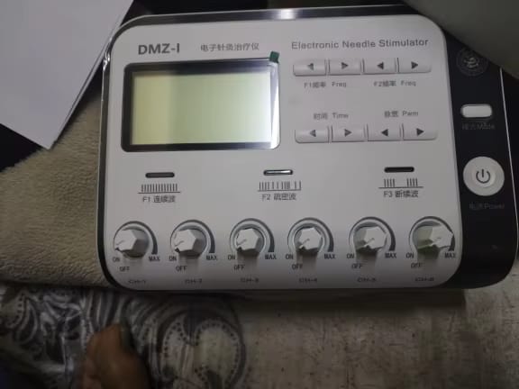Customer photo review of TENS & Electroacupuncture Muscle Stimulator
