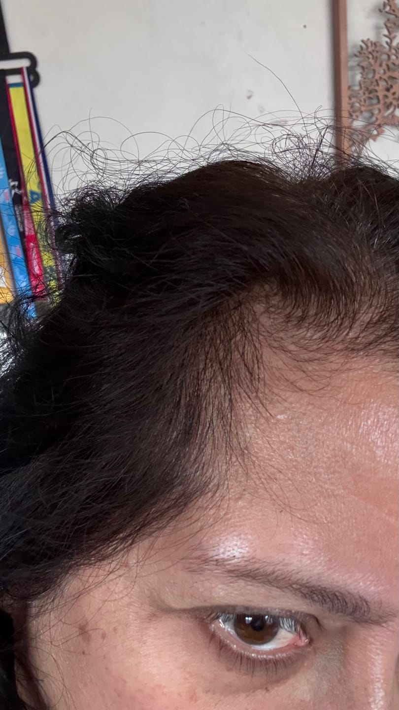 Customer photo review of Tratamiento Anticaída de Pelo para 1 Mes + Biotina