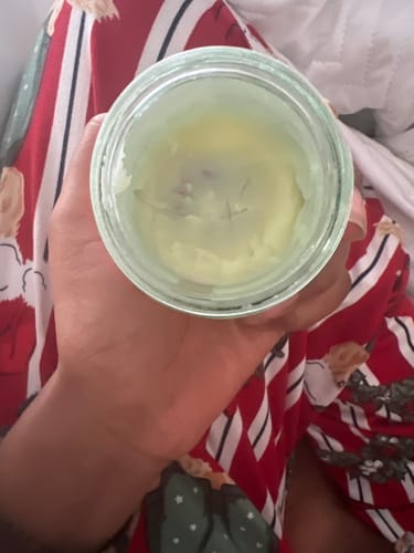 Customer photo review of Calm Balm