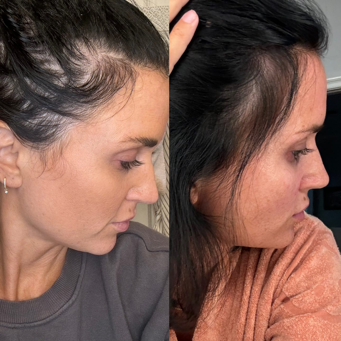 Customer photo review of Hair Growth Serum