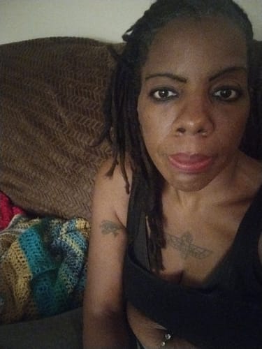 Customer photo review of Rennora Hair Growth Serum