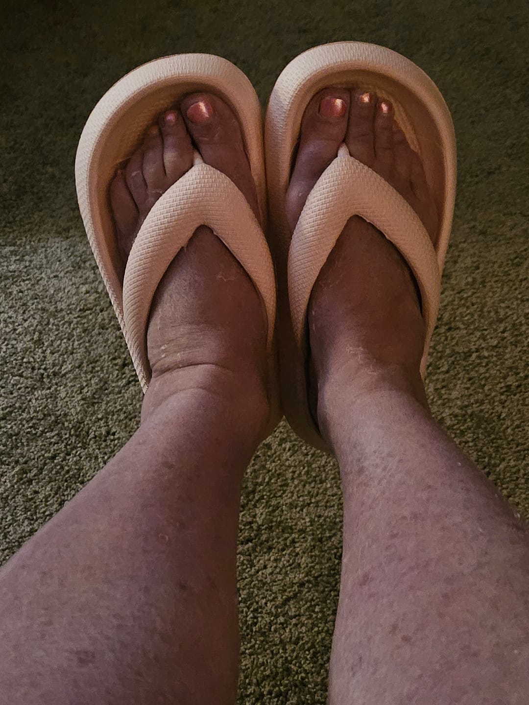 Customer photo review of Cushion Flip Flops - Cloud Slides