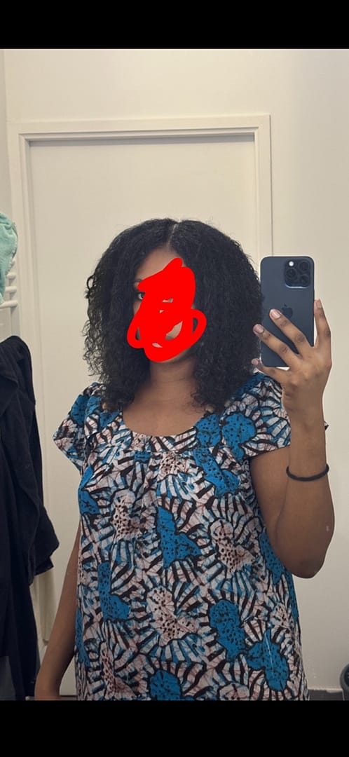Customer photo review of Pack Boost Pousse Cheveux