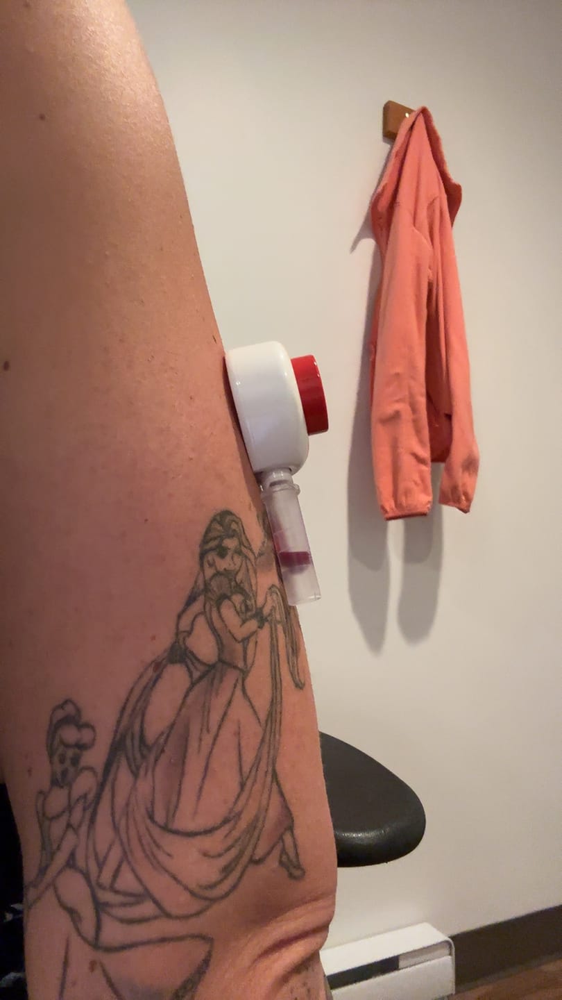 Customer photo review of EarlyReveal Tap DNA Gender Test Over 99% Accurate | Painless & Needle Free
