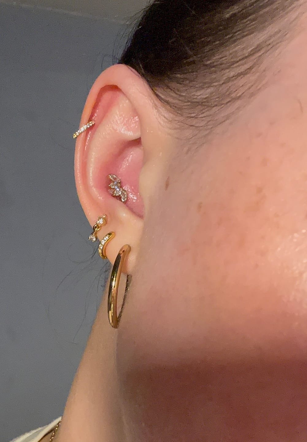 Customer photo review of ANGEL Eternity Cartilage Hoop (16g)