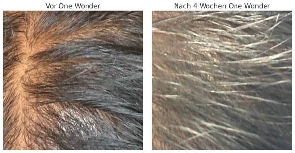 Customer photo review of ONE WONDER™ 6-IN-1 shampoo