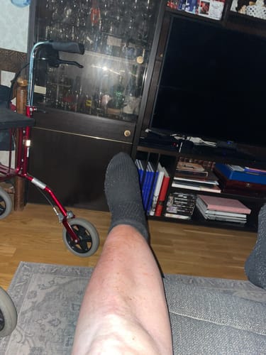 Customer photo review of Diasocks Stödstrumpor