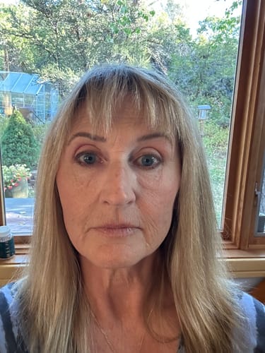 Customer photo review of The Micro Infusion System™