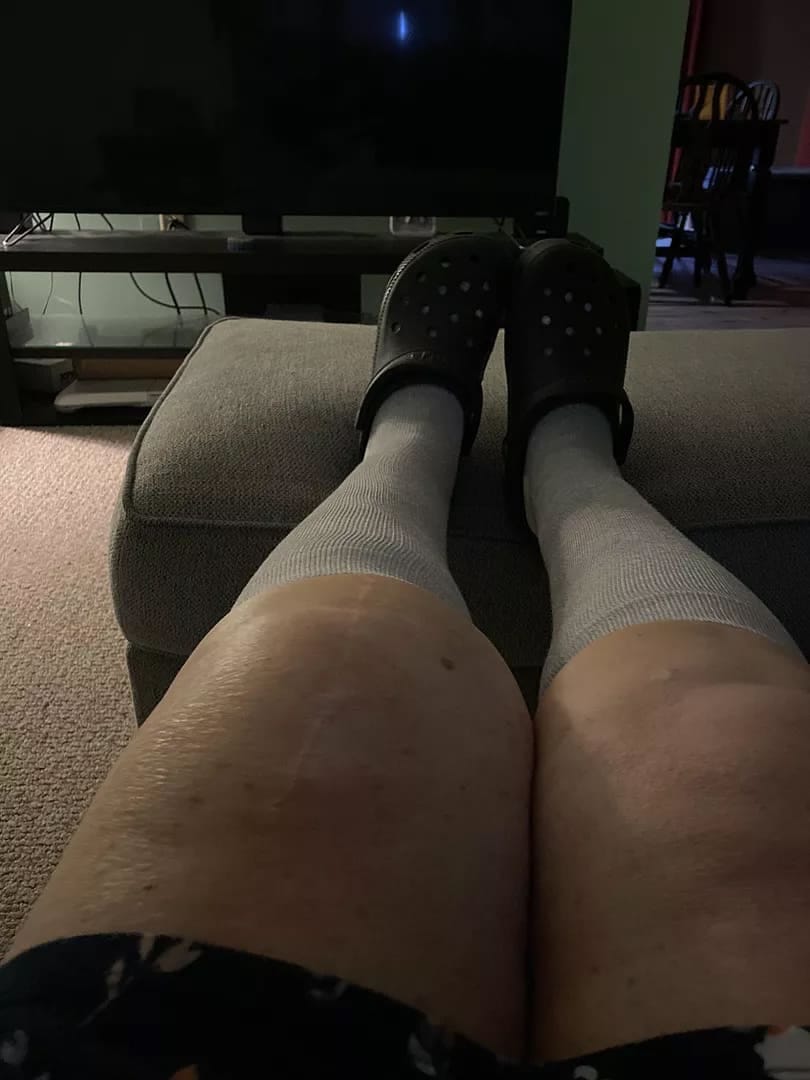 Customer photo review of Compression Socks - Cloud Slides