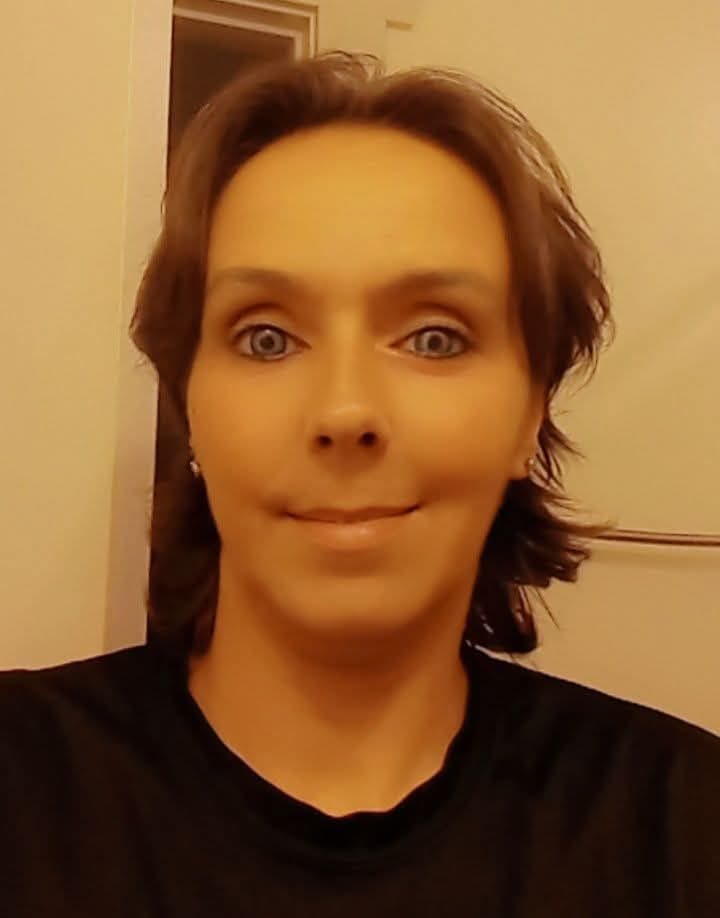 Customer photo review of Himalaya Blue Prescription Colored Contact Lenses