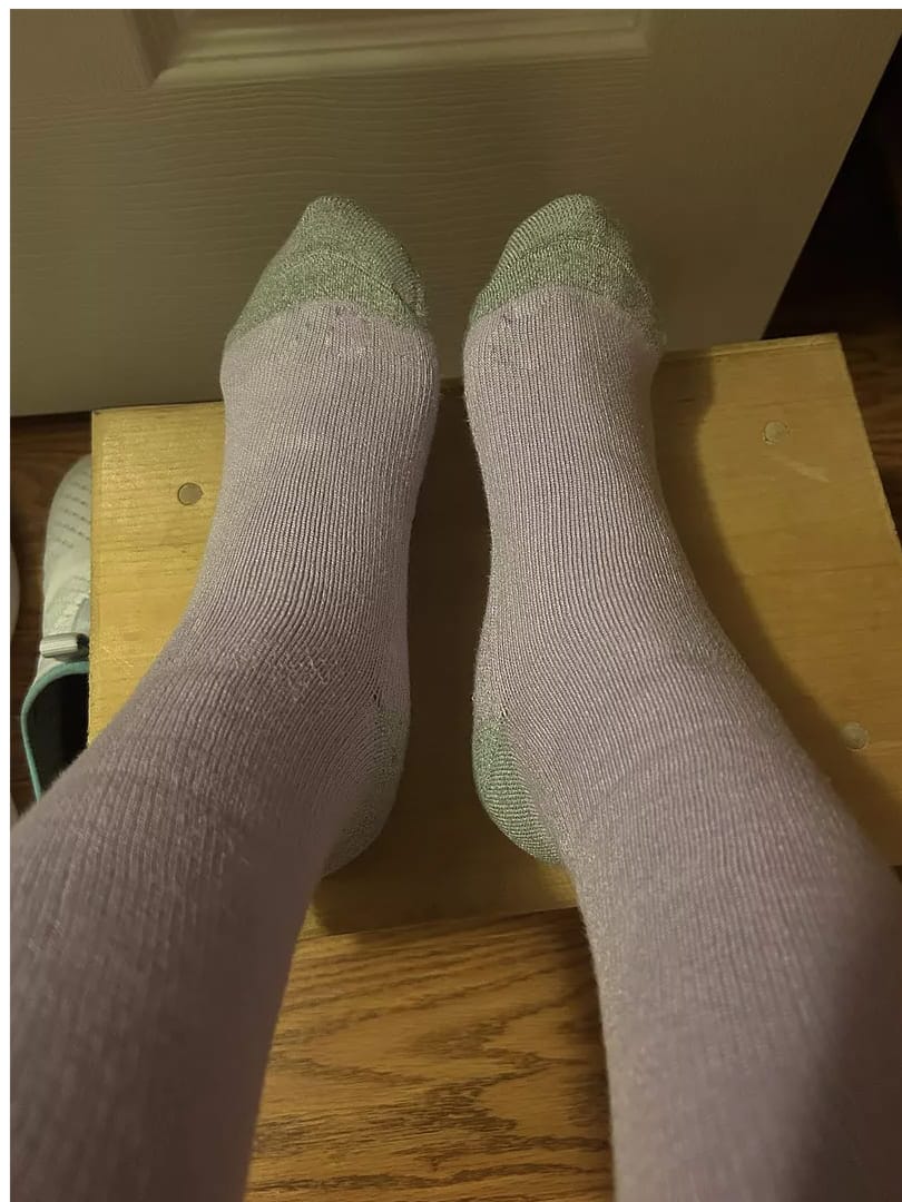 Customer photo review of Compression Socks - Cloud Slides