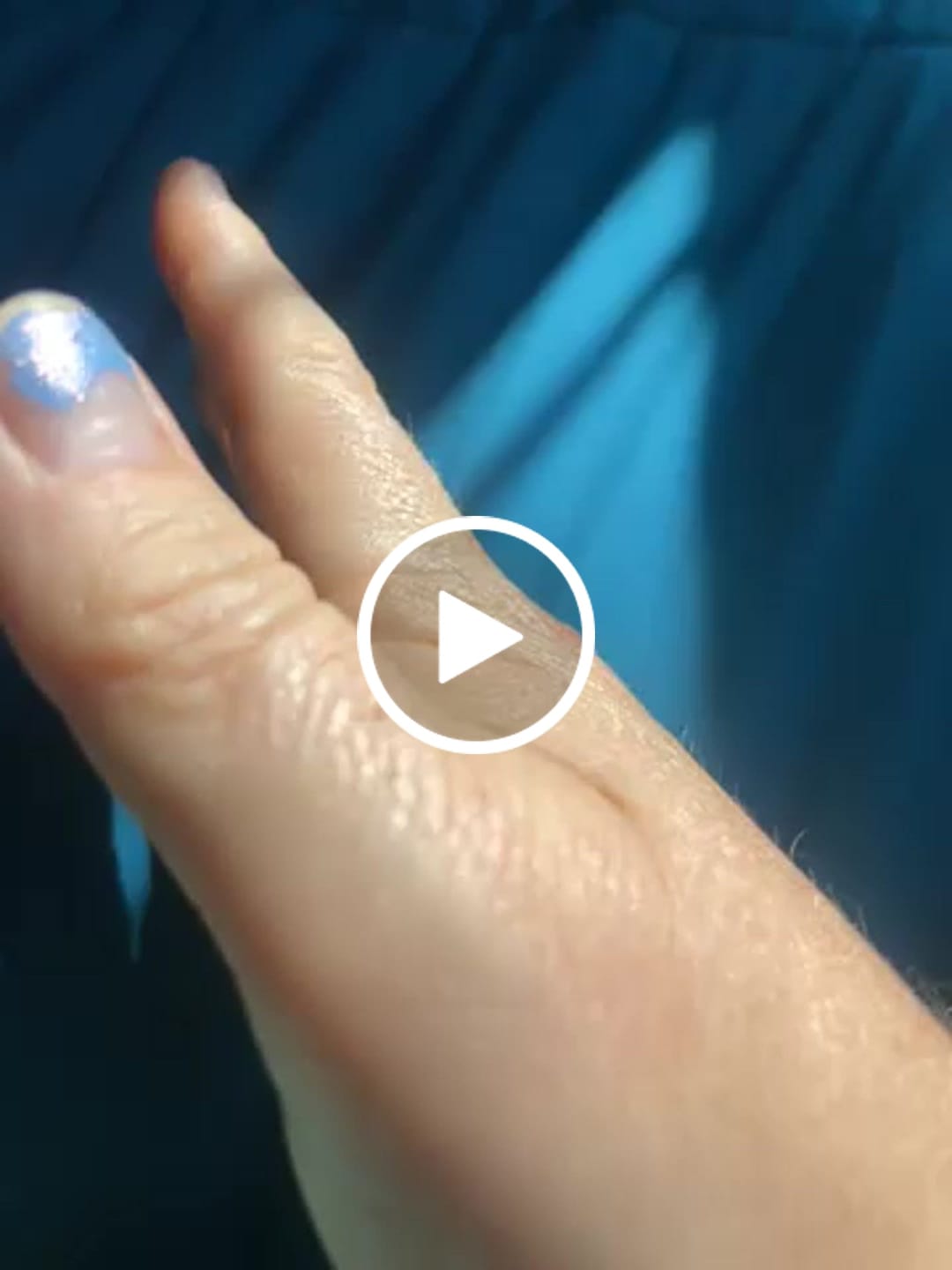 Customer video review of Sunstar Ring (Bundle)