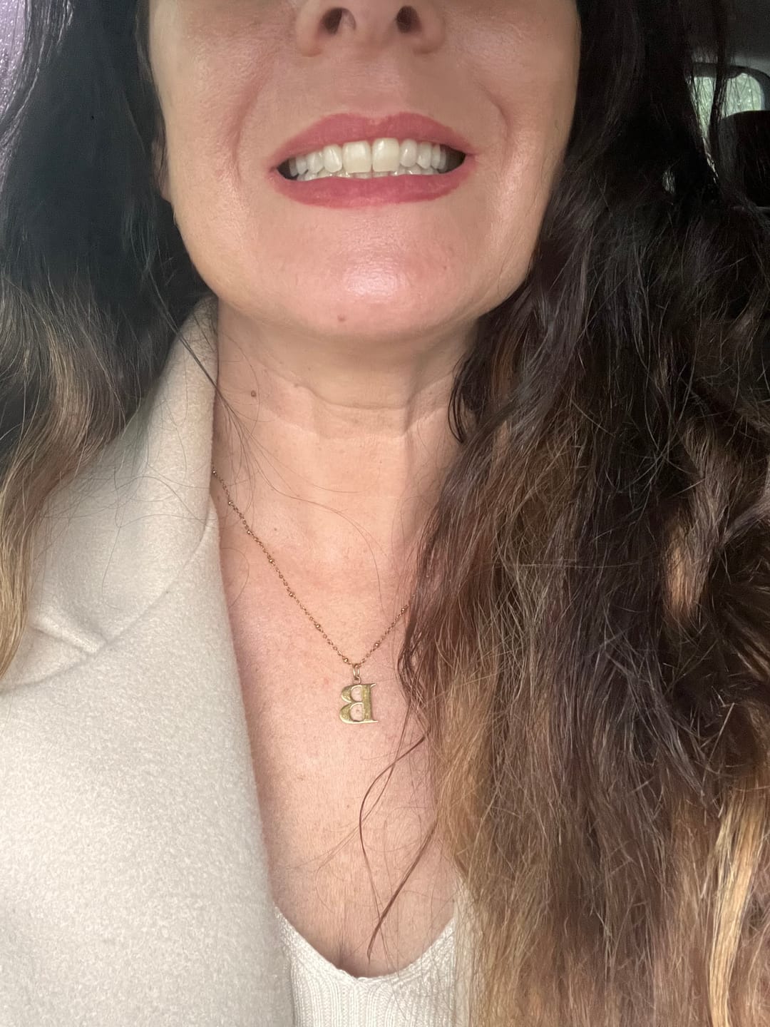 Customer photo review of Teeth Whitening Strips
