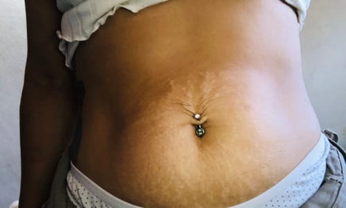 Customer photo review of Eliminá la Celulitis y las Estrías desde la Raíz: Guía Completa para una Piel Suave y Firme + 20 Regalos Extras