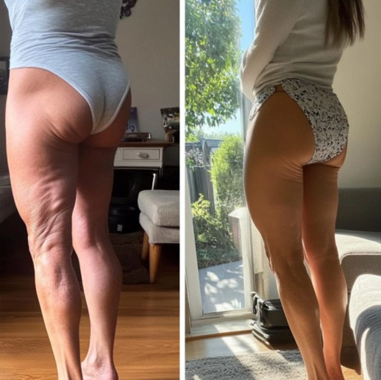 Customer photo review of Firméa® Reafirma e Hidrata la piel flácida