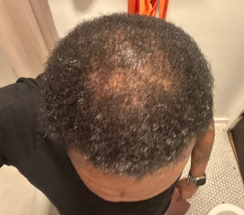 Customer photo review of Rennora Hair Growth Serum