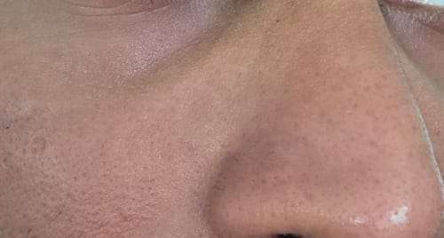 Customer photo review of Seb Natural Calming Serum