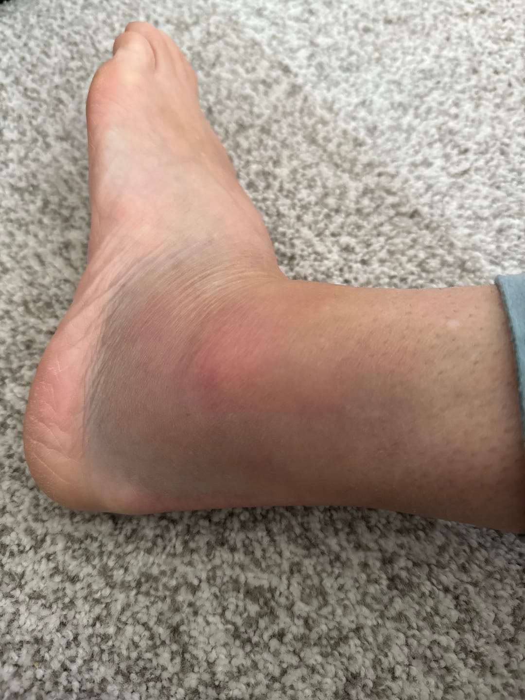 Customer photo review of Fall Challenge