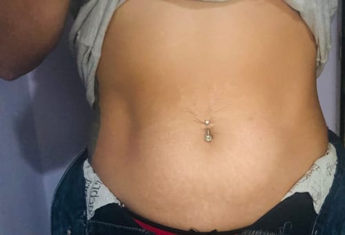 Customer photo review of Eliminá la Celulitis y las Estrías desde la Raíz: Guía Completa para una Piel Suave y Firme + 20 Regalos Extras