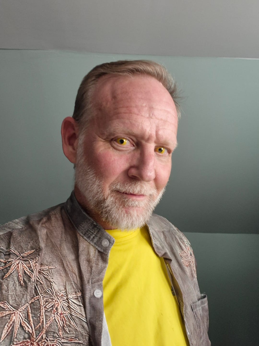 Customer photo review of Halloween Yellowout Coloured Contact Lenses