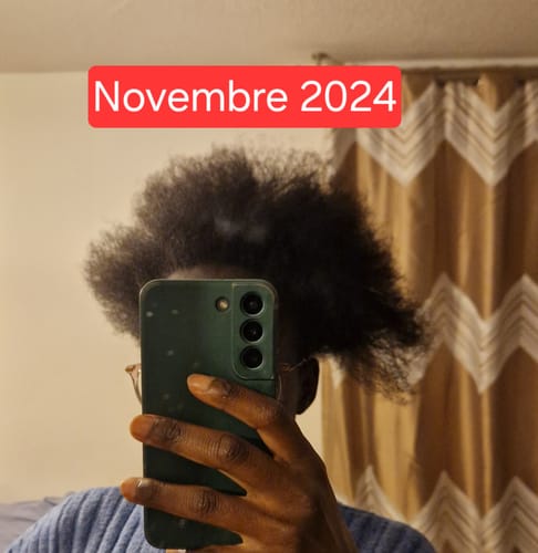 Customer photo review of Les Gummies - Croissance & volume cheveux