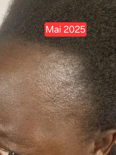 Customer photo review of Les Gummies - Croissance & volume cheveux