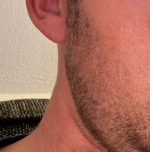 Customer photo review of Seb Natural Calming Serum