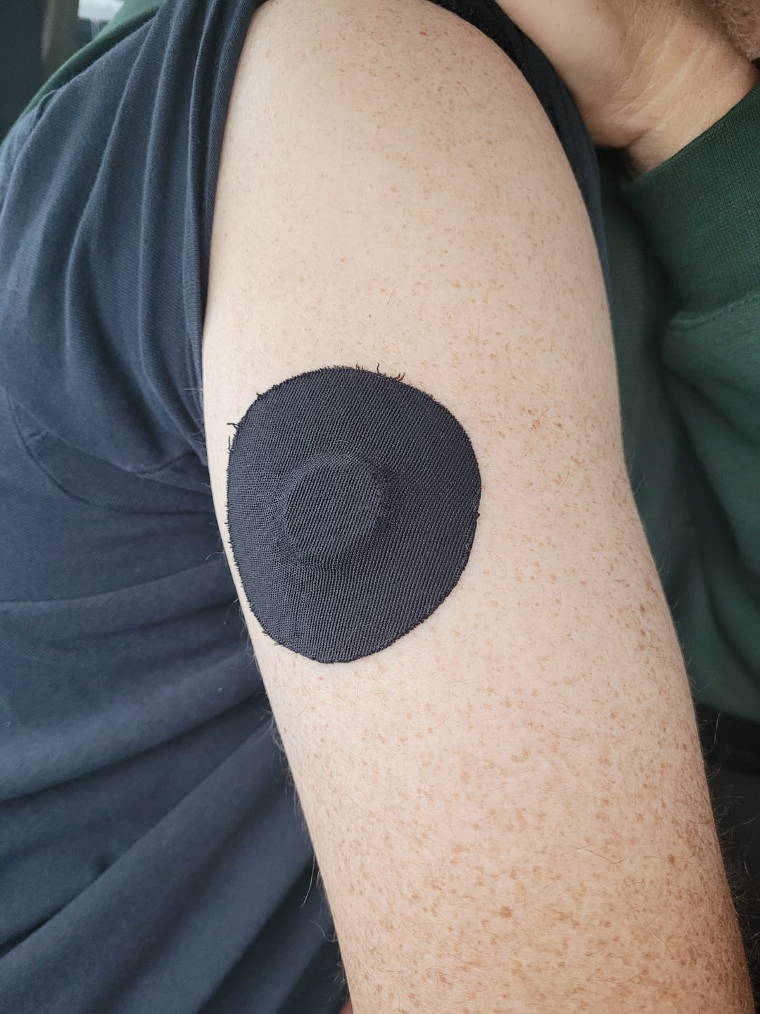 Customer photo review of Skin Grip Original - Dexcom G7 & Stelo Adhesive Patches