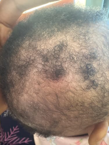 Customer photo review of Happy Scalp Cream™