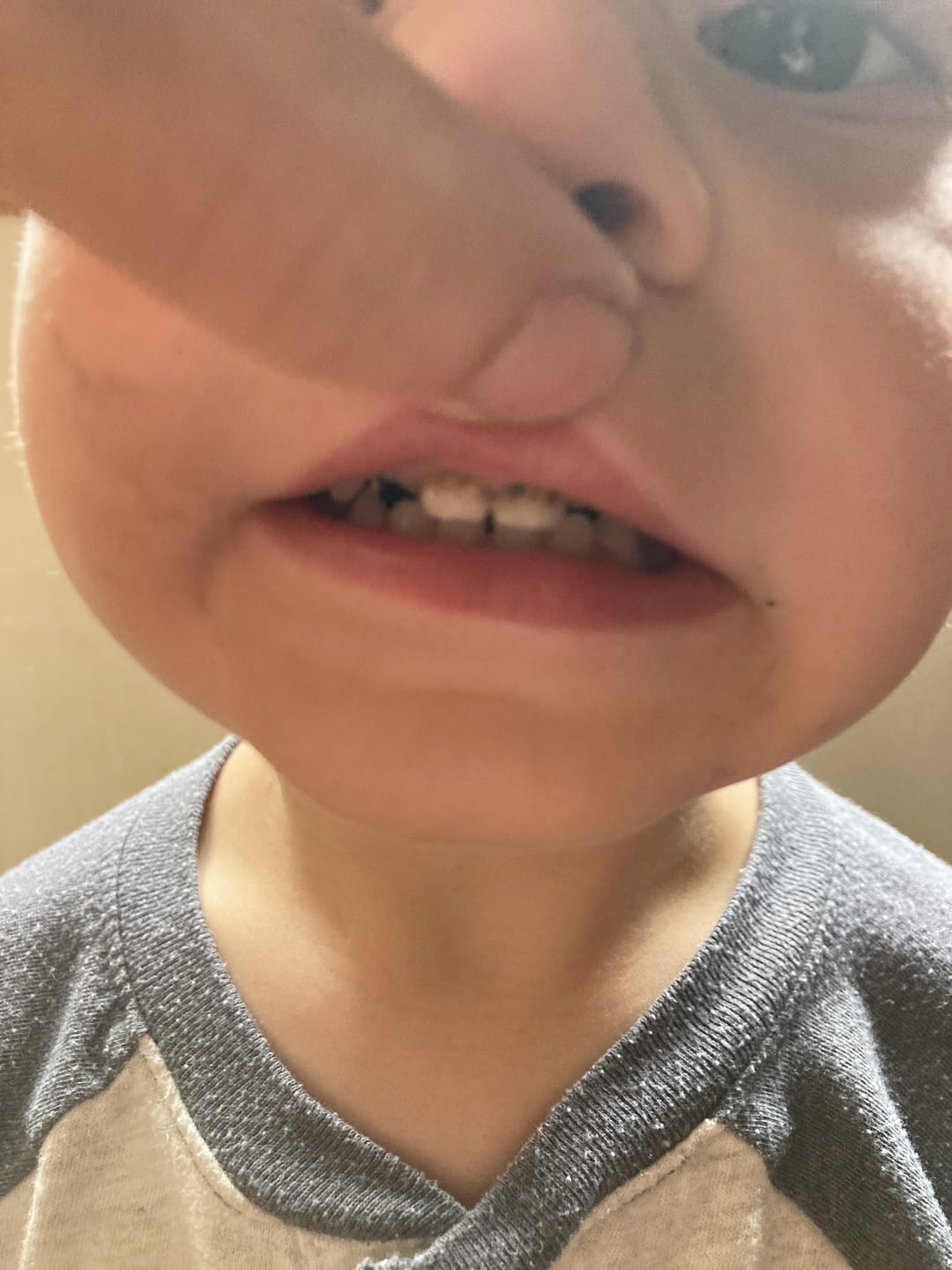 Customer photo review of Bone & Teeth Health Cell Salts - 60 ml