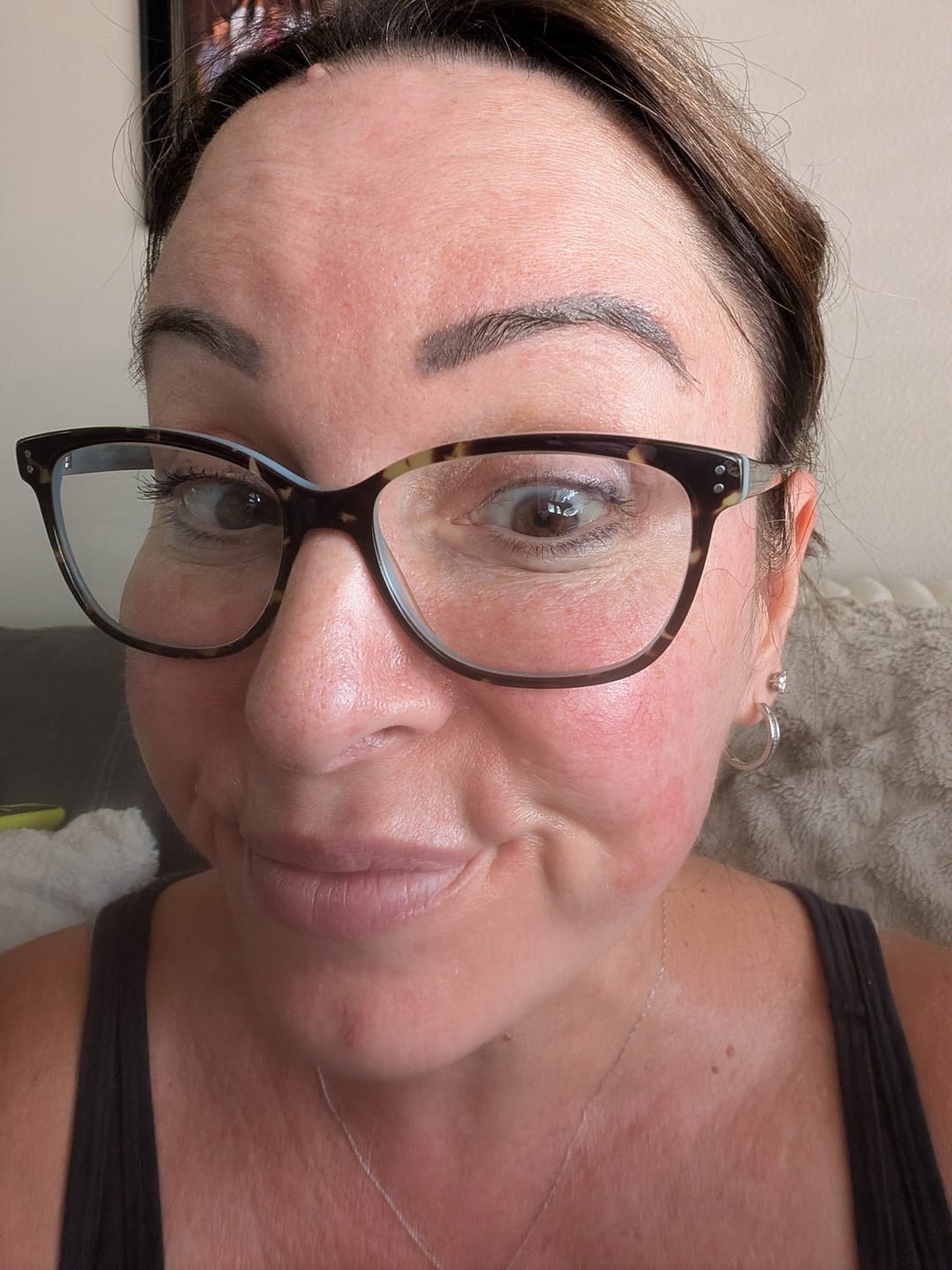 Customer photo review of Dr. Pen Hydra H5 Microneedling BB Glow Pen – Microcurrent & Serum Infusion for Professional & Home Use