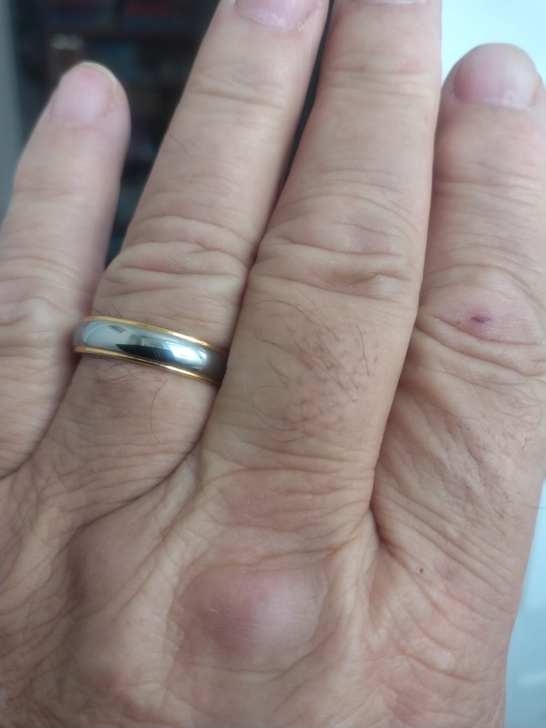 Customer photo review of The Vulcan Mirror Wonder Ring Set