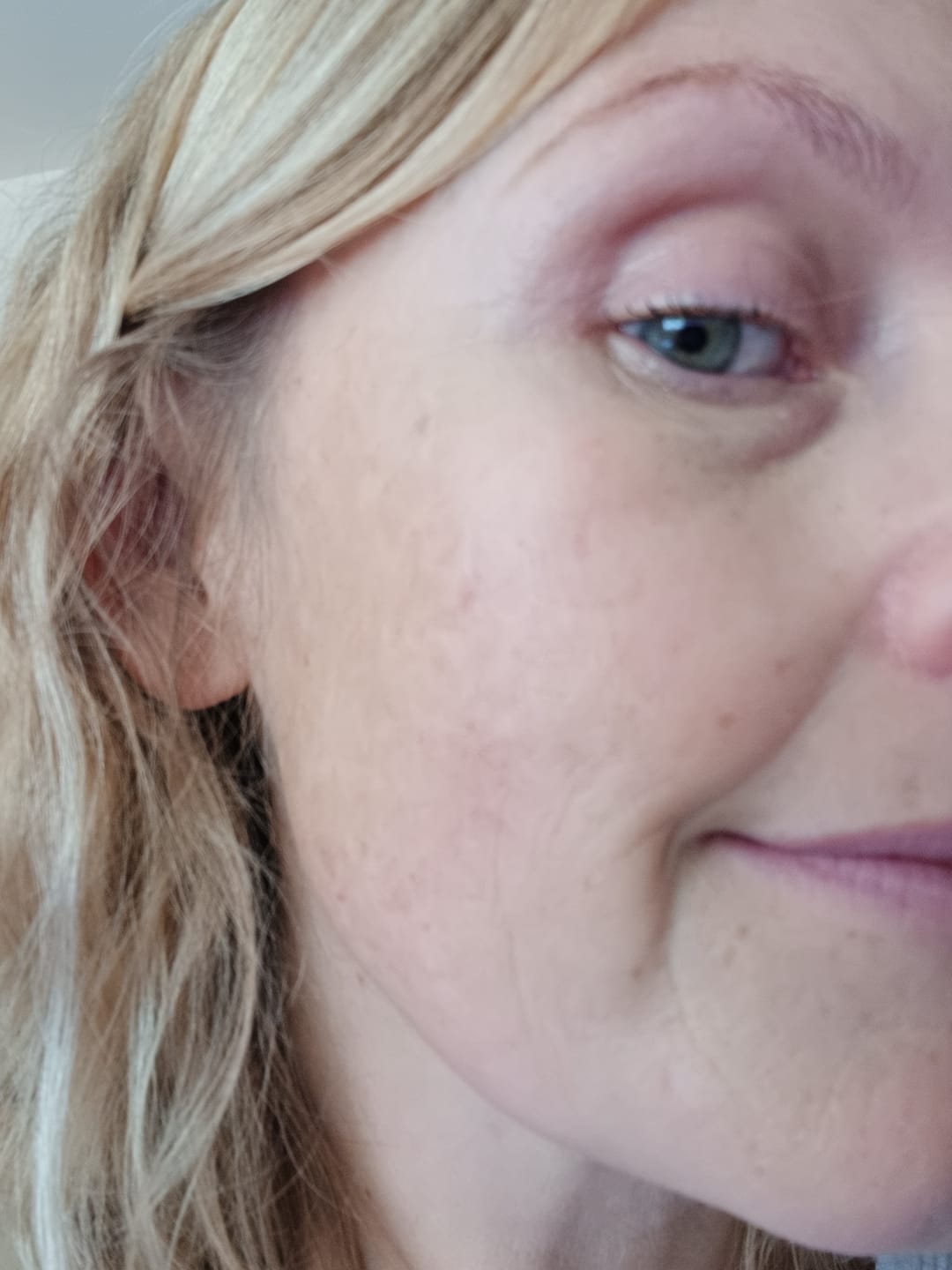 Customer photo review of The Wrinkle Defense Kit