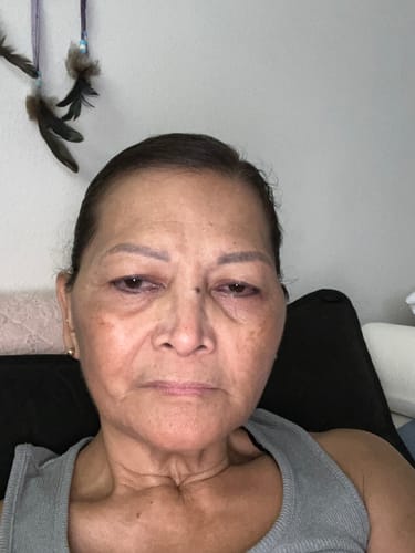 Customer photo review of Grass Fed Tallow & Manuka Honey Balm