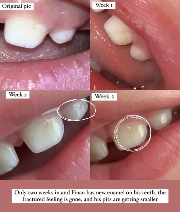 Customer photo review of Bone & Teeth Health Cell Salts - 60 ml