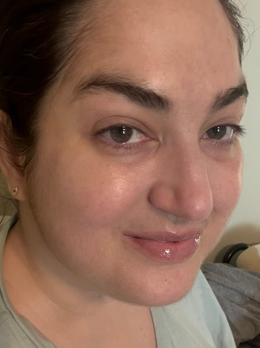 Customer photo review of Rich Rescue Phyto Mucin Cream