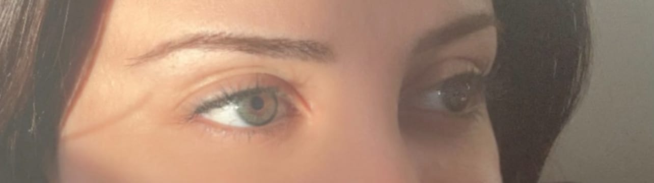 Customer photo review of 2Dadoll coko green Contact Lenses(1 pair/6 months)