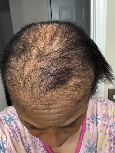 Customer result