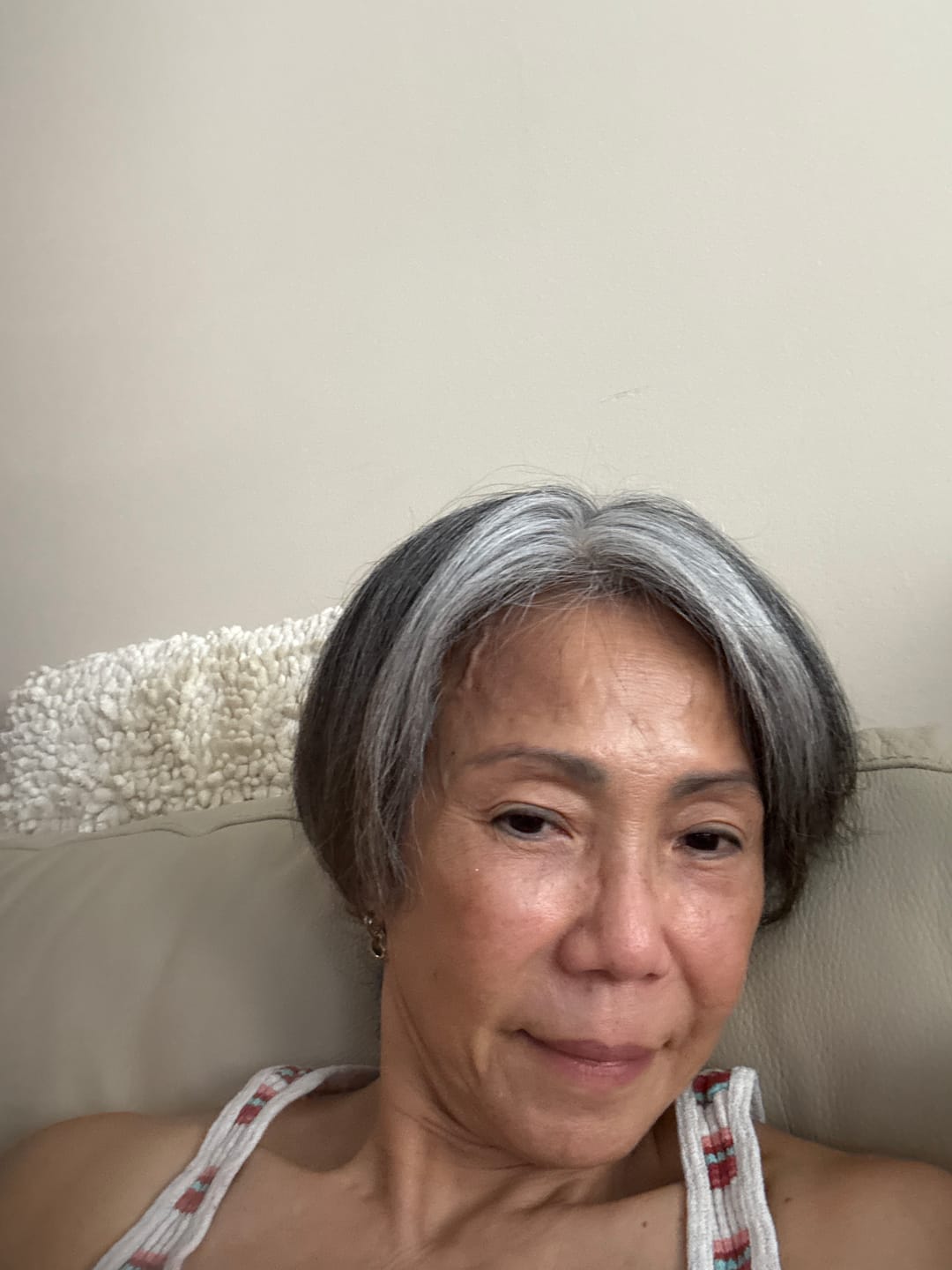Customer photo review of Glutathiosome dark spot serum Vita drop
