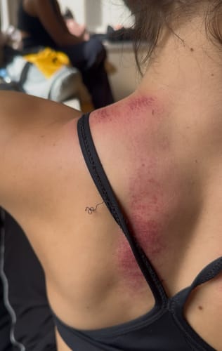 Customer photo review of Achedaway Mini Scraper：On-the-Go heated muscle scraping tool