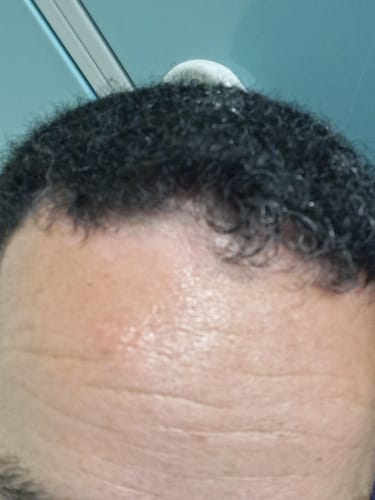 Customer photo review of Seb Natural Calming Serum