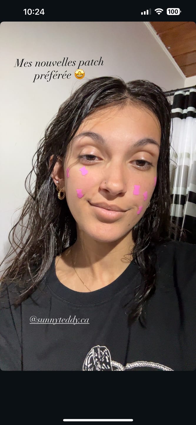 Customer photo review of Pimple Patches with Salicylic Acid - 72 Pink Teddies